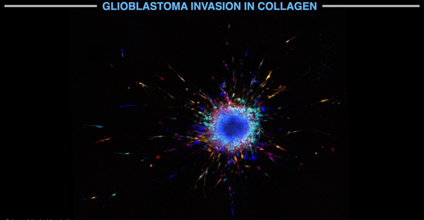 Collagen invasion assay