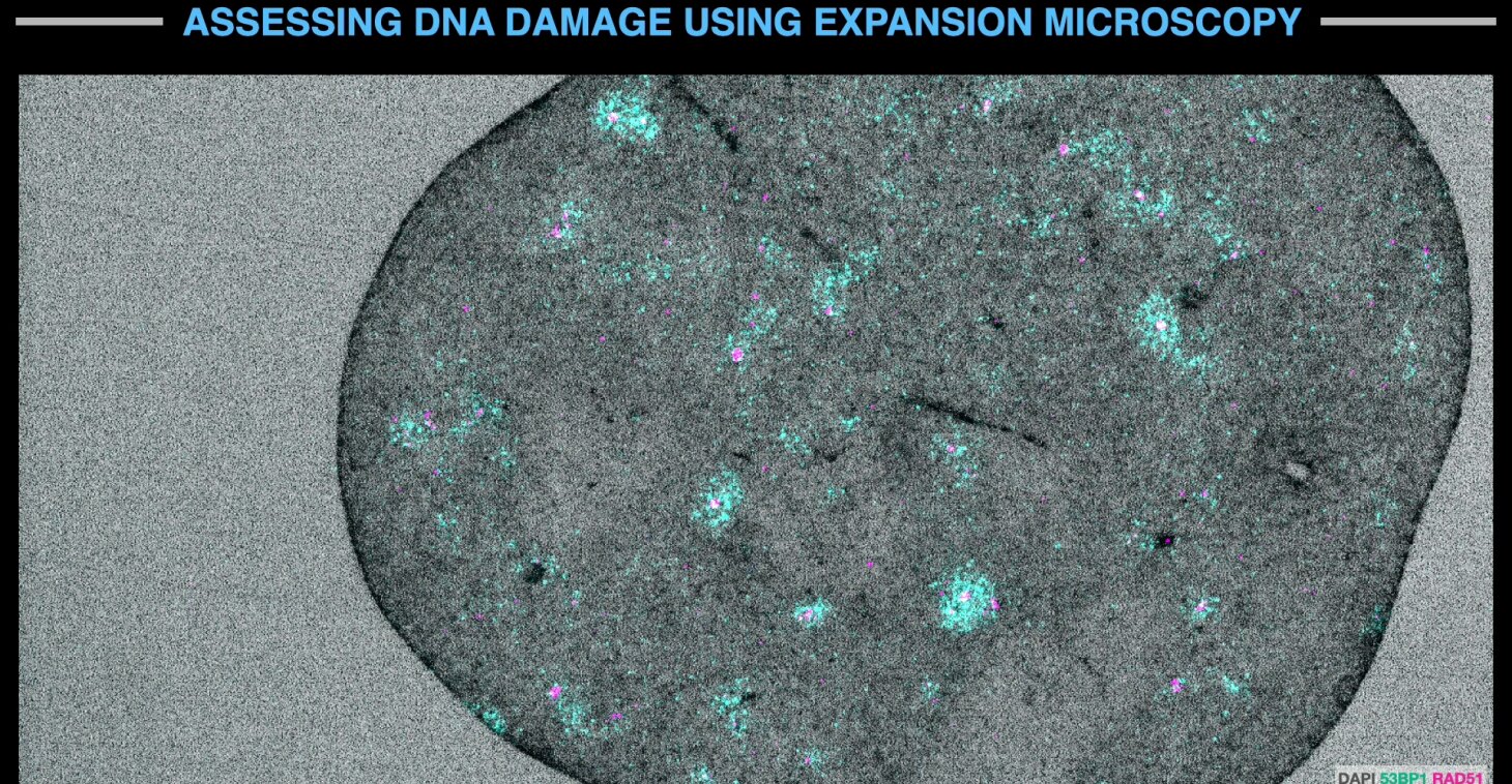 Expansion microscopy
