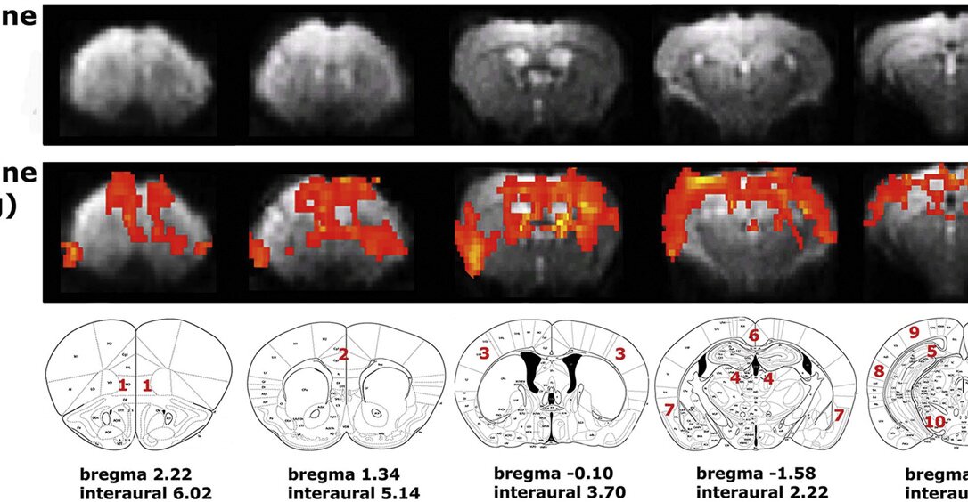 Pharmacological MRI with scopolamine