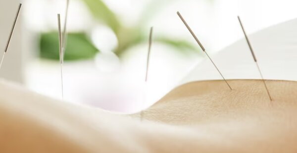Lezing Acupunctuur: meridianen (nieuw!)