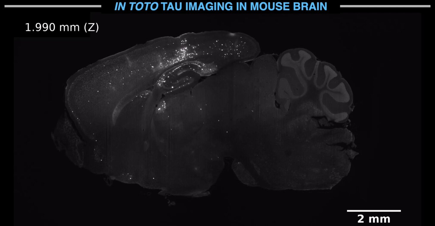 Brain