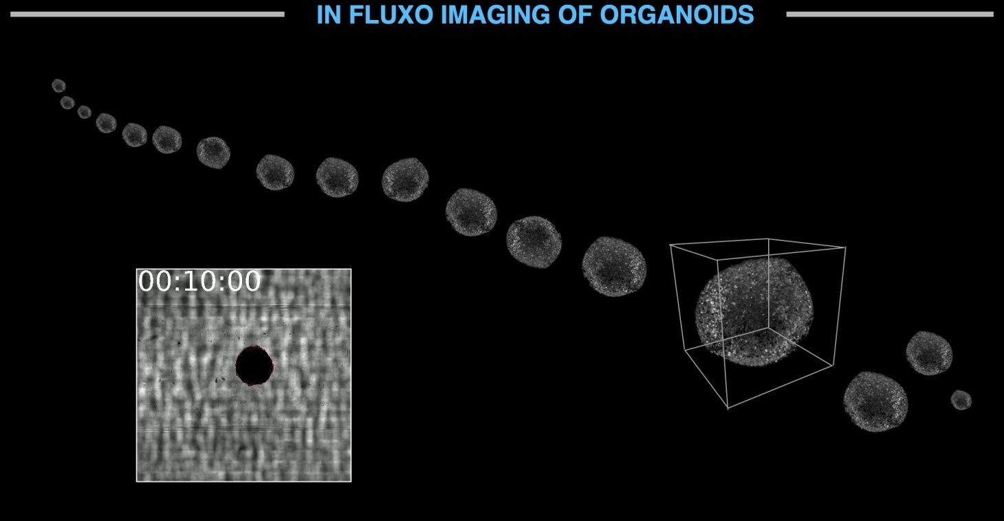 Organoid screening