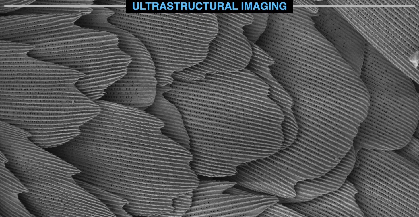 Ultrastructural imaging