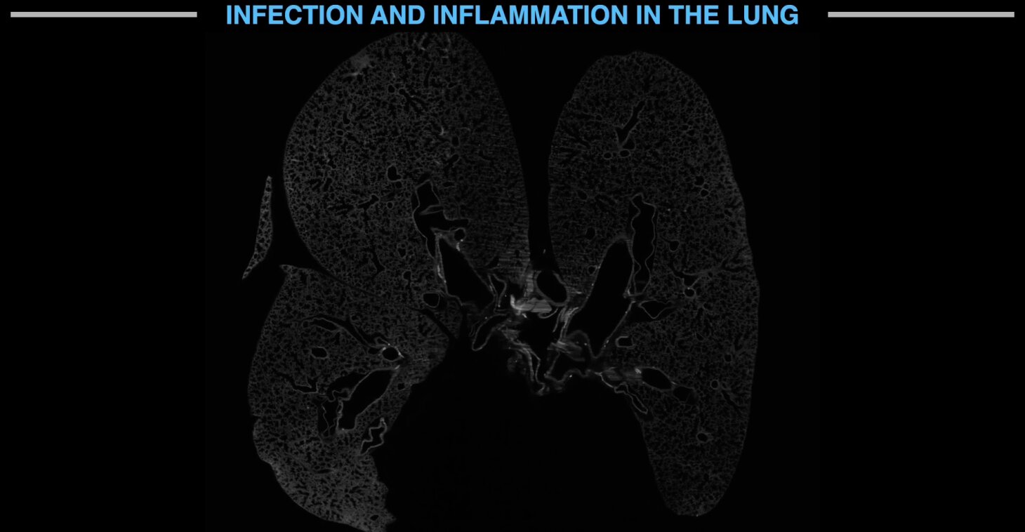 Lung
